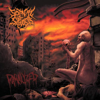 SPINAL STENOSIS - Paralyzed