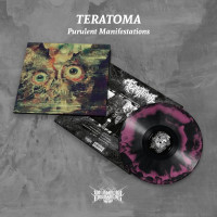TERATOMA - Purulent Manifestations (ltd.)