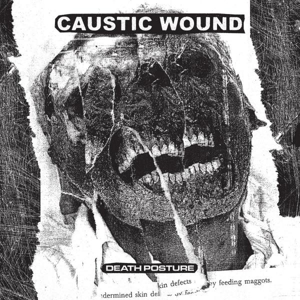 CAUSTIC WOUND Death Posture
