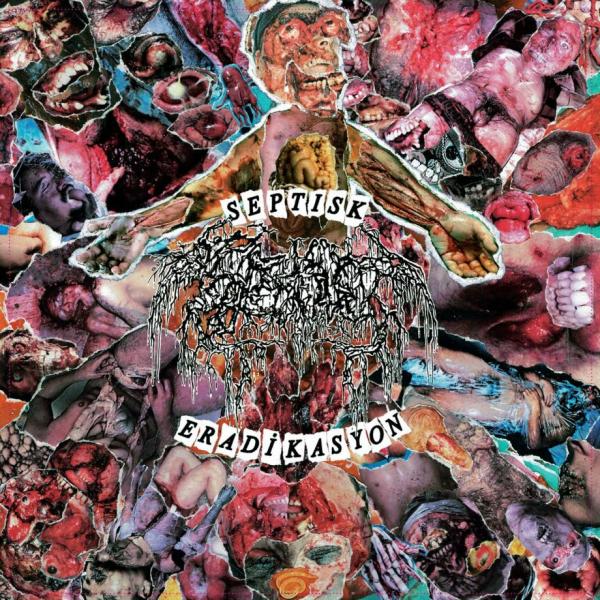 SEPTAGE Septisk eradikasyon (7")